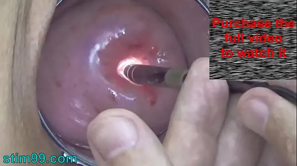 Show Endoscope Camera inside Cervix Cam into Pussy Uterus energy Clips